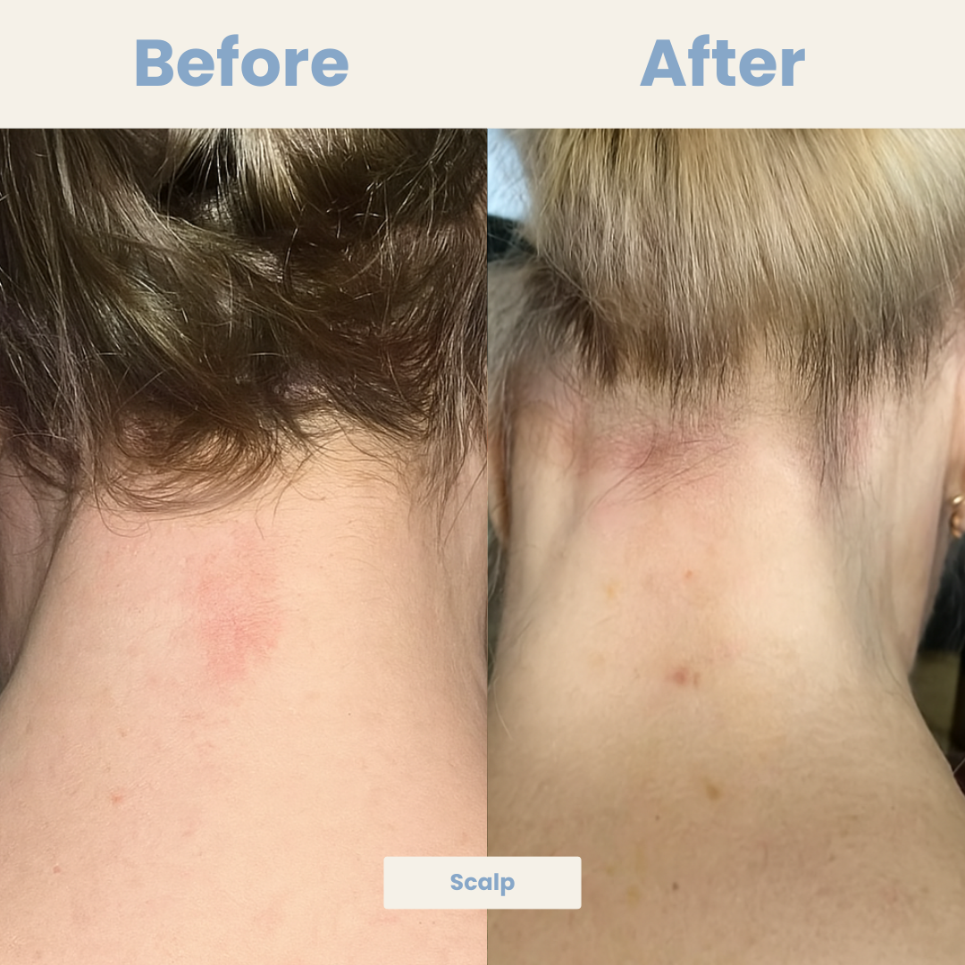 SkinRenew Skin Probiotic Capsules - 60 Days